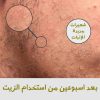 ⁦beard oil⁩ - الصورة ⁦4⁩