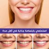⁦• عرض حبتين جيل تبييض وتنظيف الاسنان السحري⁩ - الصورة ⁦6⁩